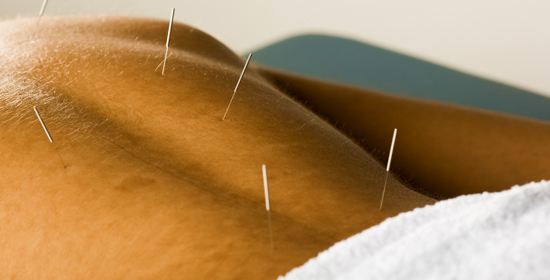 Akupunktura je dobrá prevence proti nemocem